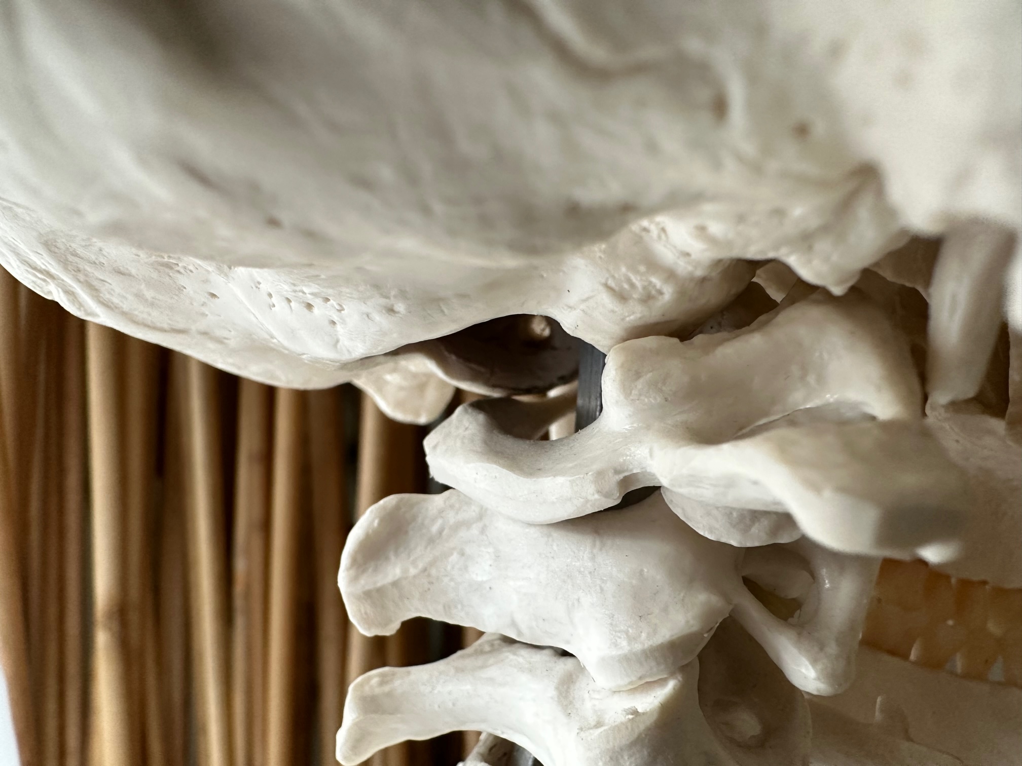 découvrez comment l'ostéopathie, pourrait vous aider à éliminer vos maux de tetes.